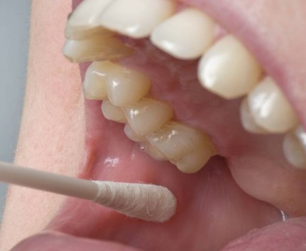 Krebsvorsorge beim Zahnarzt